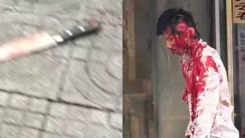 广西柳州斗殴持刀砍头皮