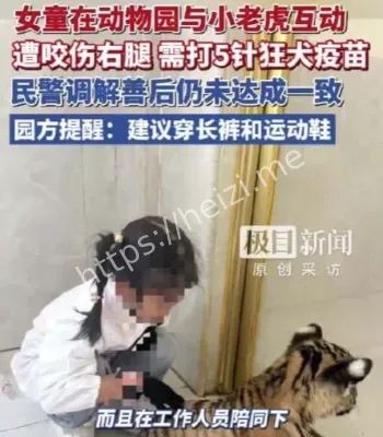 女童被小老虎咬伤