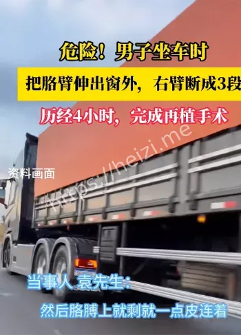 男子胳膊断3截