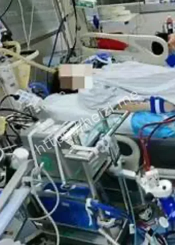 长途火车久坐风险