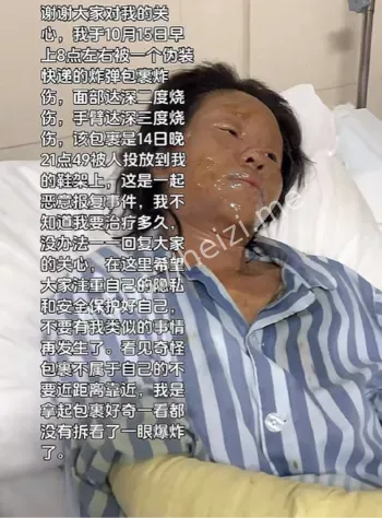 手臂深三度烧伤