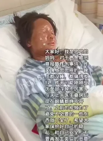 网红隐私暴露直播风险